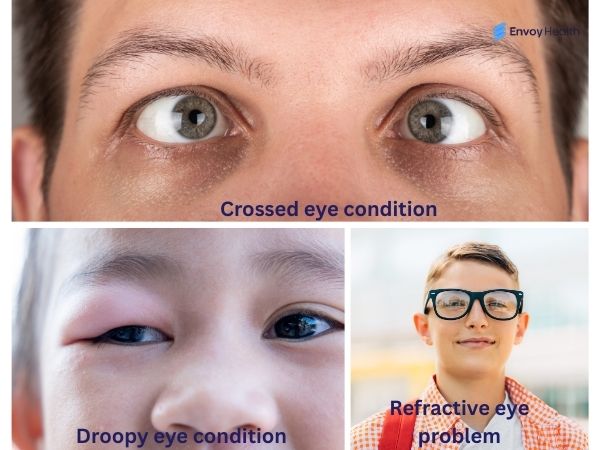 Underlying eye issues that lead to Lazy Eye condition 