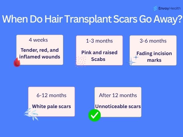 When do hair transplant scars go away Image 