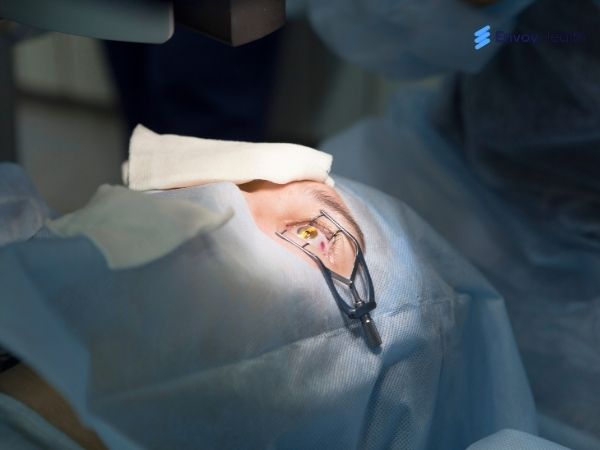 LASIK Eye surgery 