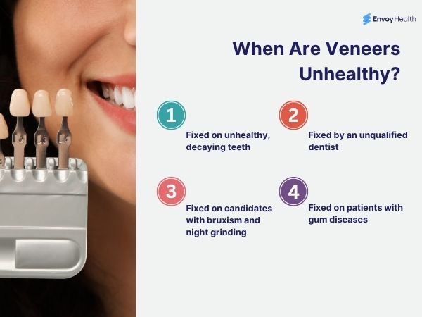 When veneers become harmful for natural teeth