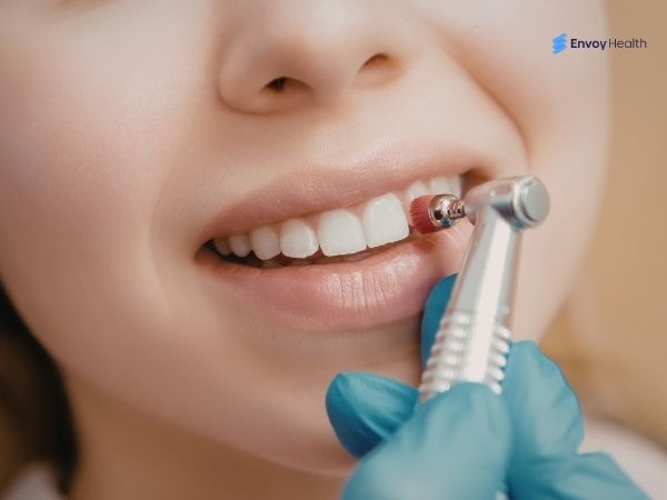 Dental cleaning procedure 