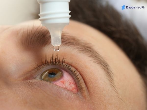 Using eyedrops after laser eye surgery