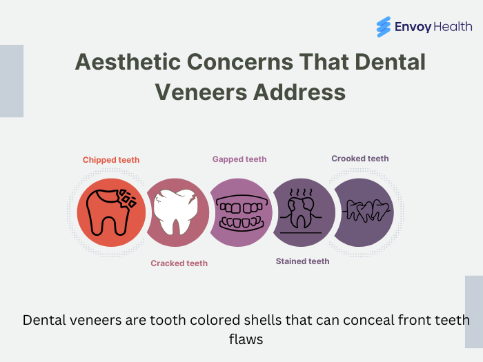 Aesthetic Concerns That Dental Veneers Address