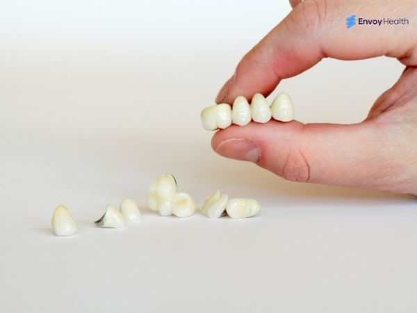 Dental Bridge 