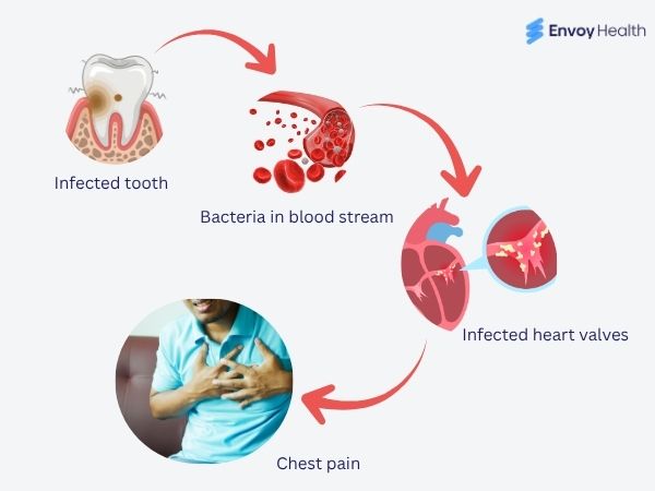 Flowchart of how bacteria cause heart problem