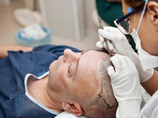 patient undergoing Hair transplant surgery