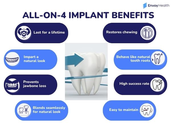 all-on-4 Implant Benefits