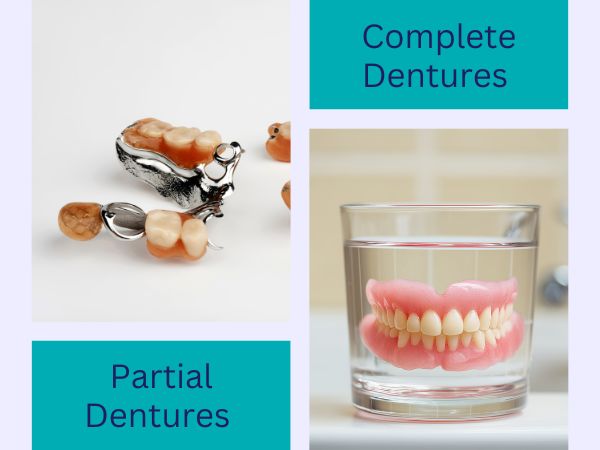 Partial and Complete Dentures