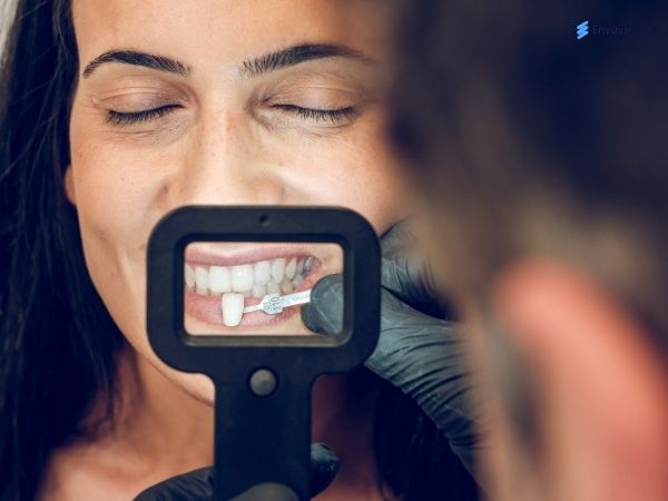 Veneer placement on patient teeth